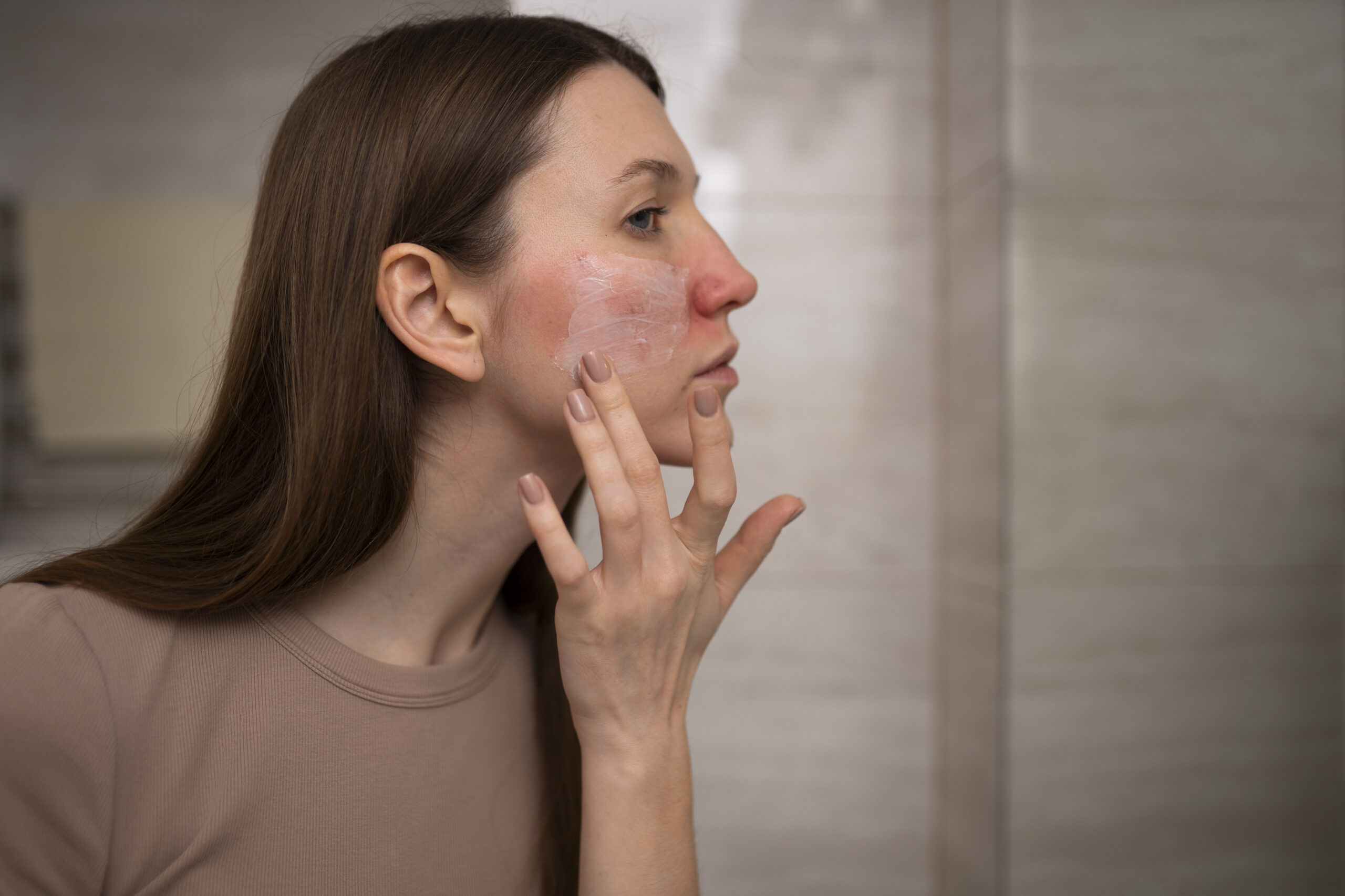 Woman with dry skin