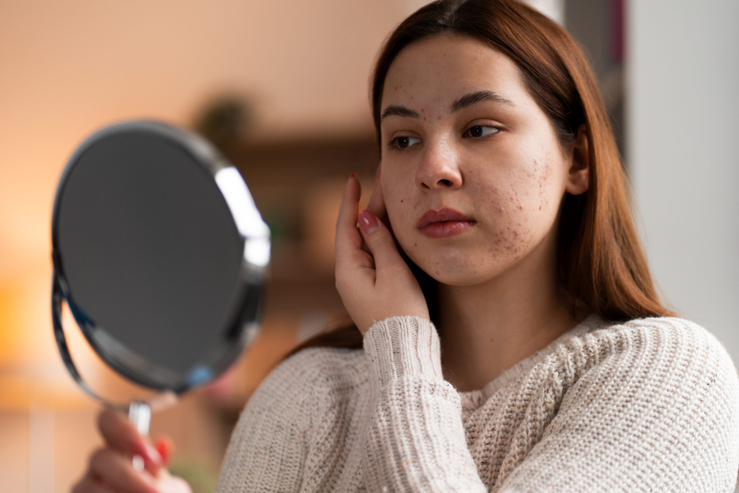 Woman looks at her acne in the mirror