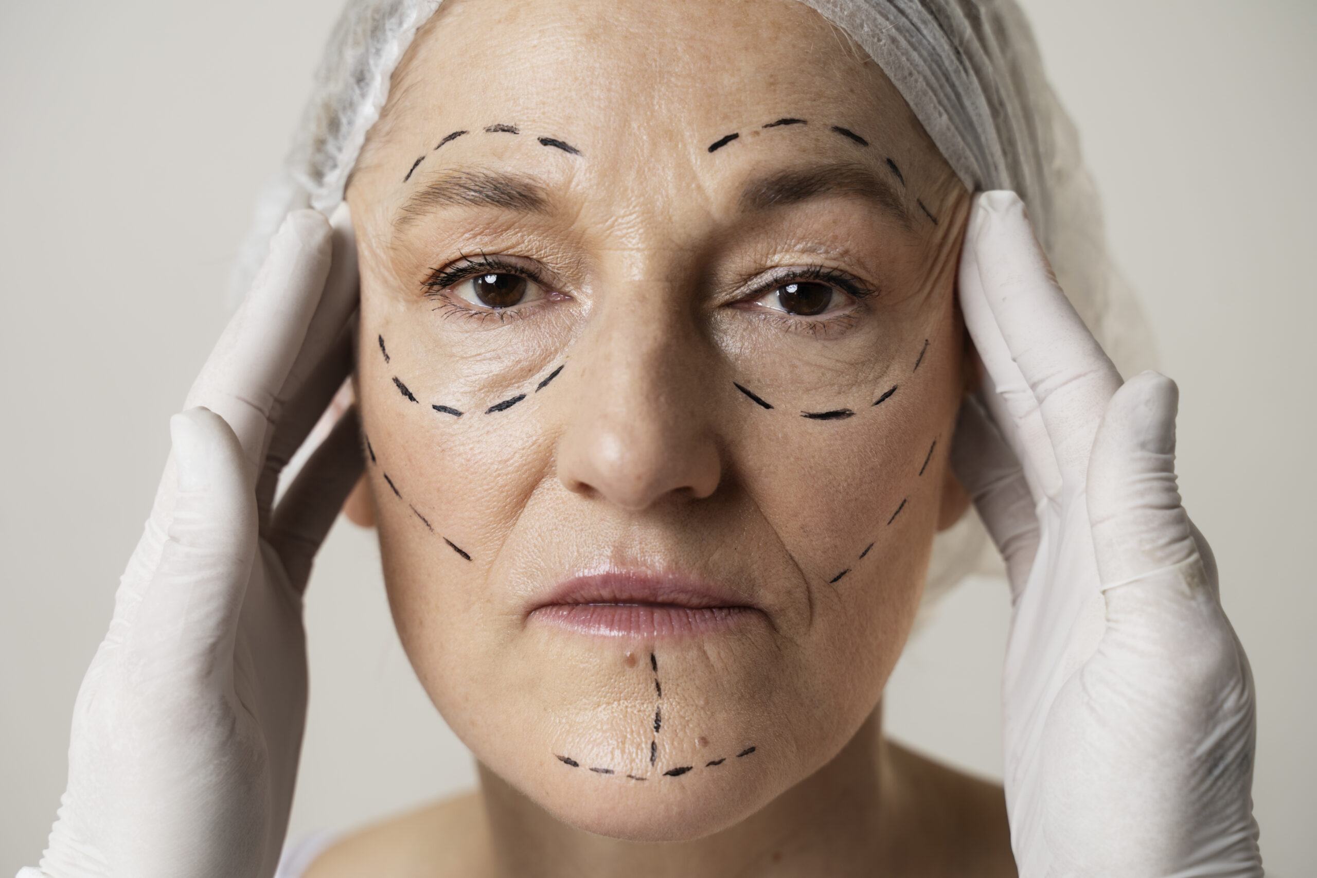 he3ad on view of womans face with surgical head cap and hands with surgical gloves on either side where her face has surgical marks all over