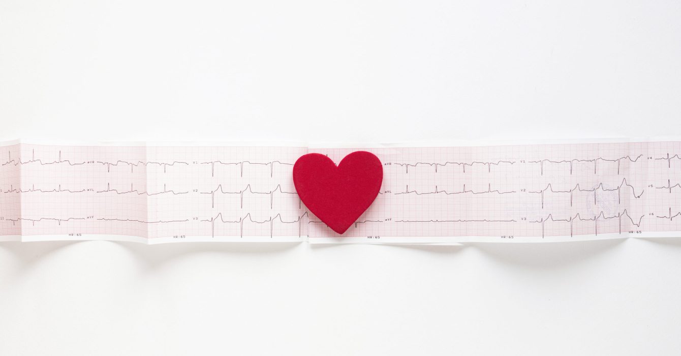 top-view-medical-cardiogram-with-heart